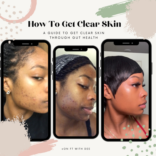How To Get Clear Skin E-book ( a guide to get clear skin through gut health)